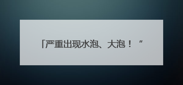 严重出现水泡、大泡！“防晒霜”你用对了吗？
